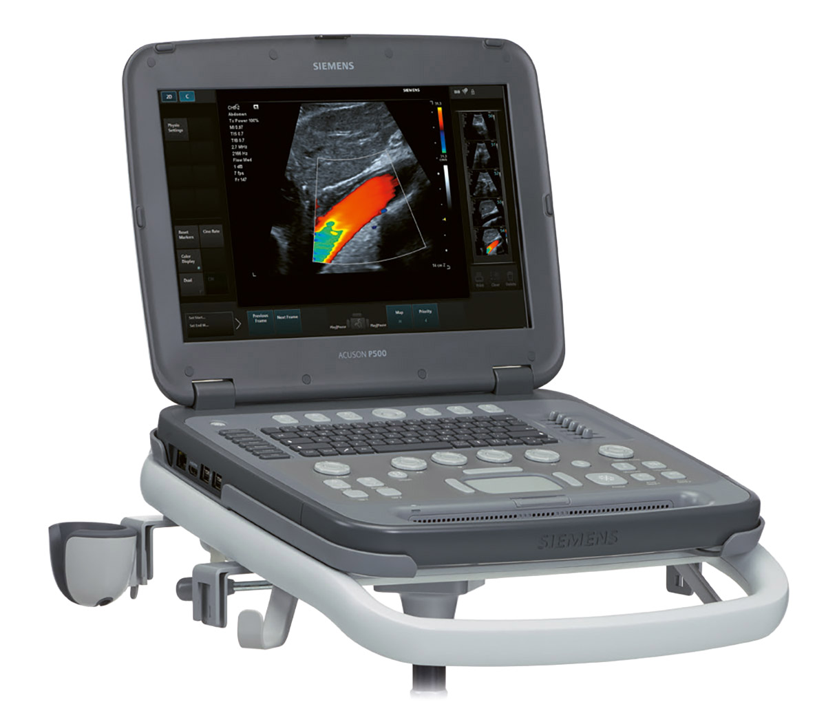 Siemens Acuson P500 Portable Ultrasound