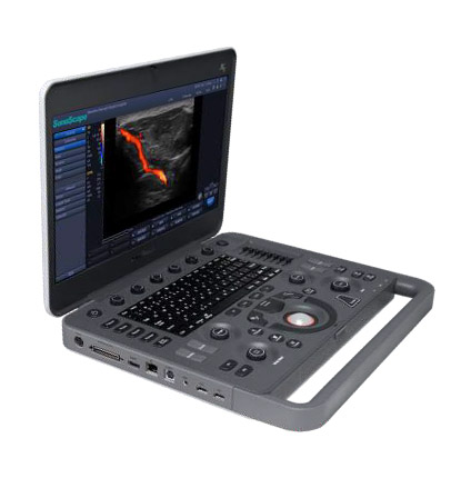 SonoScape X5 Ultrasound
